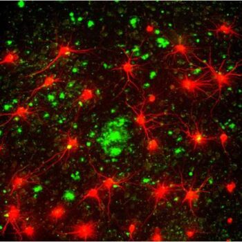 Neurons at the Entorhinal Cortex injected with Alexa 594 and amyloid plaques were stained with Thioflavin S