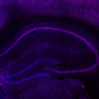 cFos staining in the hippocampus