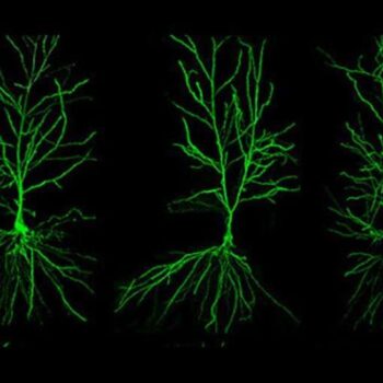 Hippocampal Neurons injected with Lucifer Yellow and captured with a confocal microscope